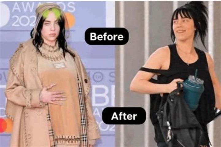 Billie Eilish Weight Loss Transformation: Here Are Before And After Pictures