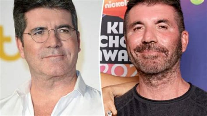 
Simon Cowell Before And After Looks: The X Factor Creator Went Too Far With The Plastic Surgery 