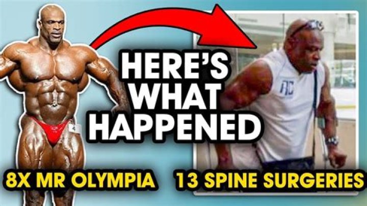 
What Happened To Ronnie Turner? What Did Ronnie Turner Die From? Who Is Ronnie Turner? Ronnie Turner Wikipedia, Age, Cause Of Death, Parents And More 