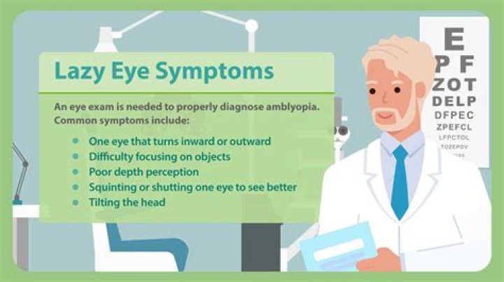 
Why Does Romesh Ranganathan Have A Lazy Right Eye? Childhood Infection Problem Explained 